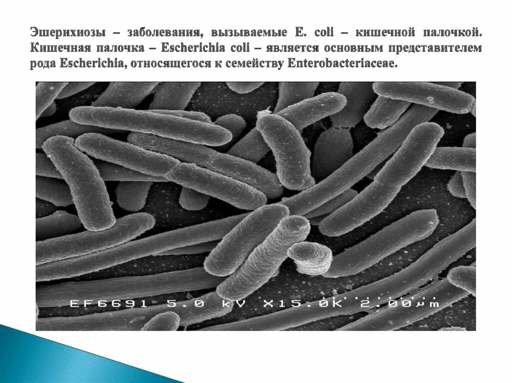 Кишечная палочка вызывает заболевания. Кишечная палочка e.coli. Кишечная палочка эшерихиоз. Кишечная палочка Escherichia coli. Инфекции, вызываемые Escherichia coli.