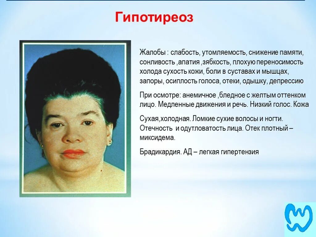Жалобой пациента при гипотиреозе является тест. Жалобой пациента при гипотиреозе является тест. Гипотиреоз диагностика. Гипотиреоз клинчискмя катрина. Основные клинические симптомы гипотиреоза.