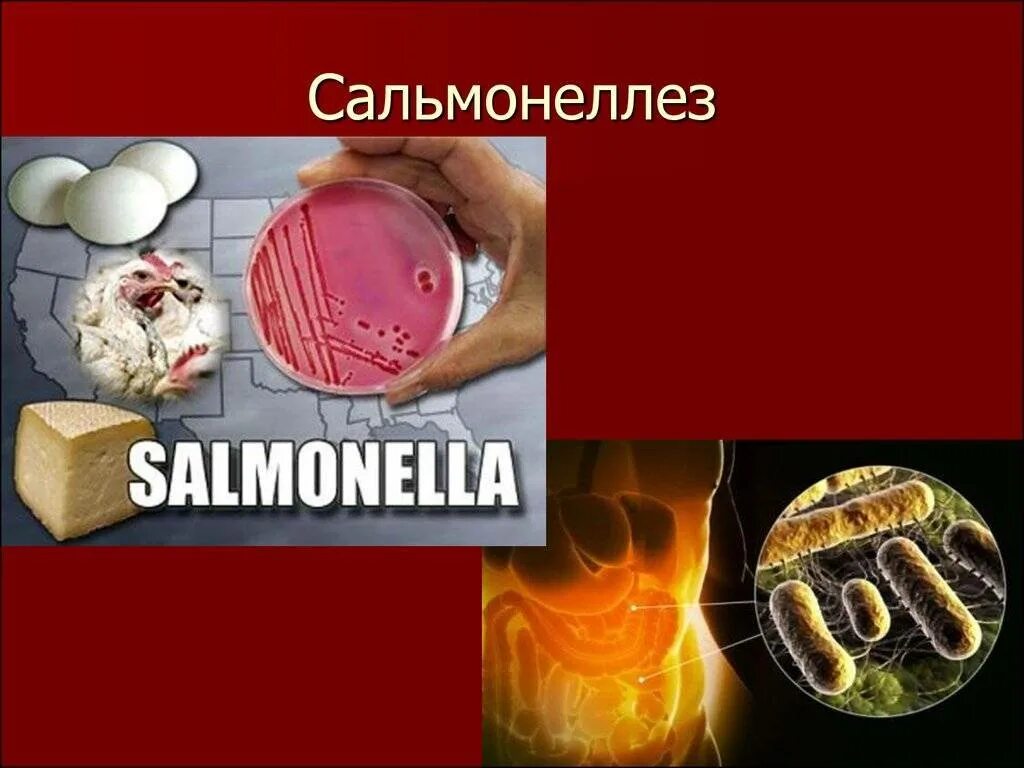 Сальмонеллез. Samonellyoz. Сальмонеллез профилактика заболевания. Кишечные инфекции сальмонеллез. Сальмонеллез у детей клинические