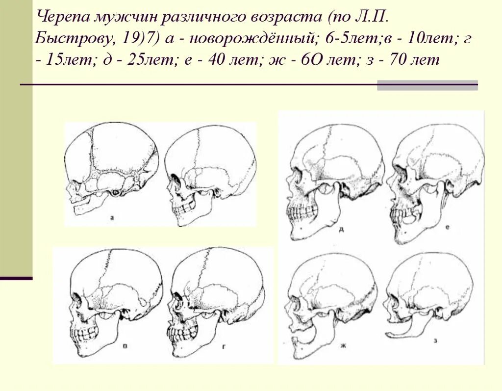 Возрастные особенности формирования черепа. Возворастные ищменнеия череп. Возрастные изменения черепа человека. Череп человека в разном возрасте. Признак возрастных изменений костей