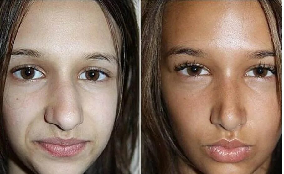 Упражнения для носогубок. У гаврилы оттопырились губы и суженные глаза. У гаврилы оттопырились губы и суженные глаза. У гаврилы оттопырились губы и суженные глаза. У гаврилы оттопырились губы и суженные глаза.