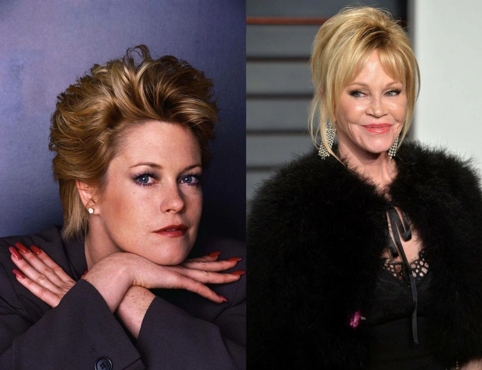 Дженис дикинсон неудачная пластика. Мелани гриффит после пластики. Актрисы после операций. Актрисы после операций. Пластические операции звезд голливуда.