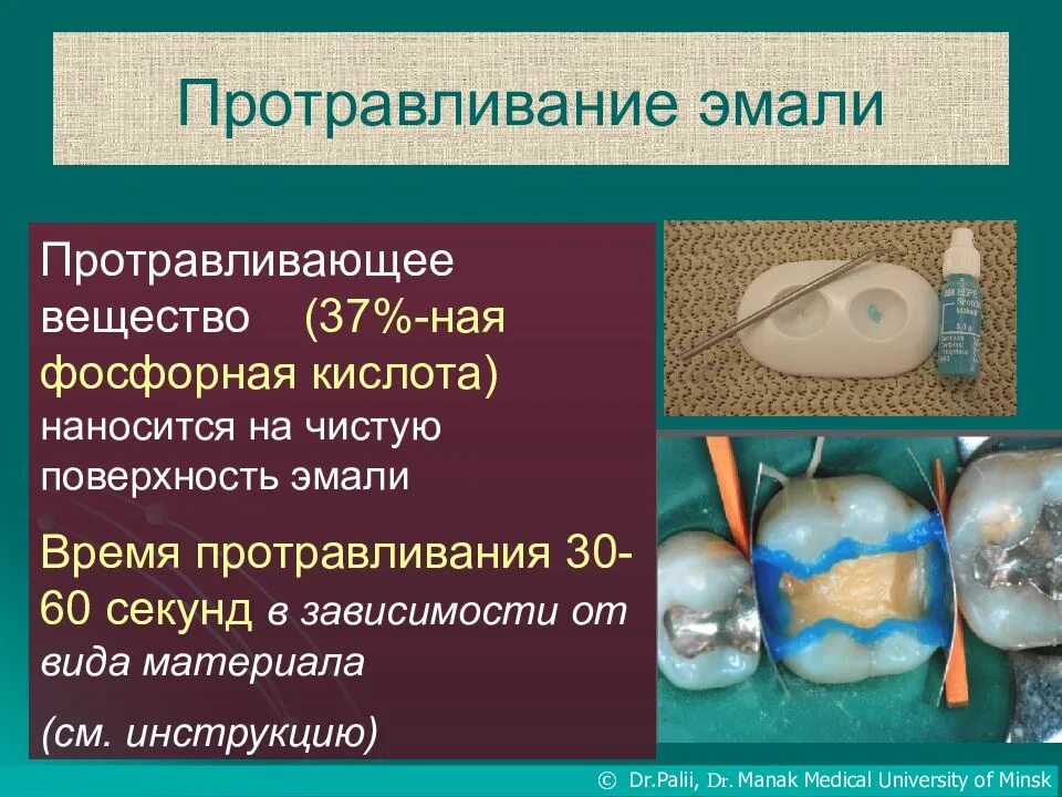 Полости туловища. Серозная оболочка. Полость употреблять. Полости тела человека таблица. Полости тела человека.