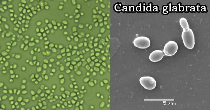 Кандида спп ниже. Candida tropicalis микробиология. кандида глабрата микроскопия. кандида альбиканс микроскопия. кандида тропикалис под микроскопом.