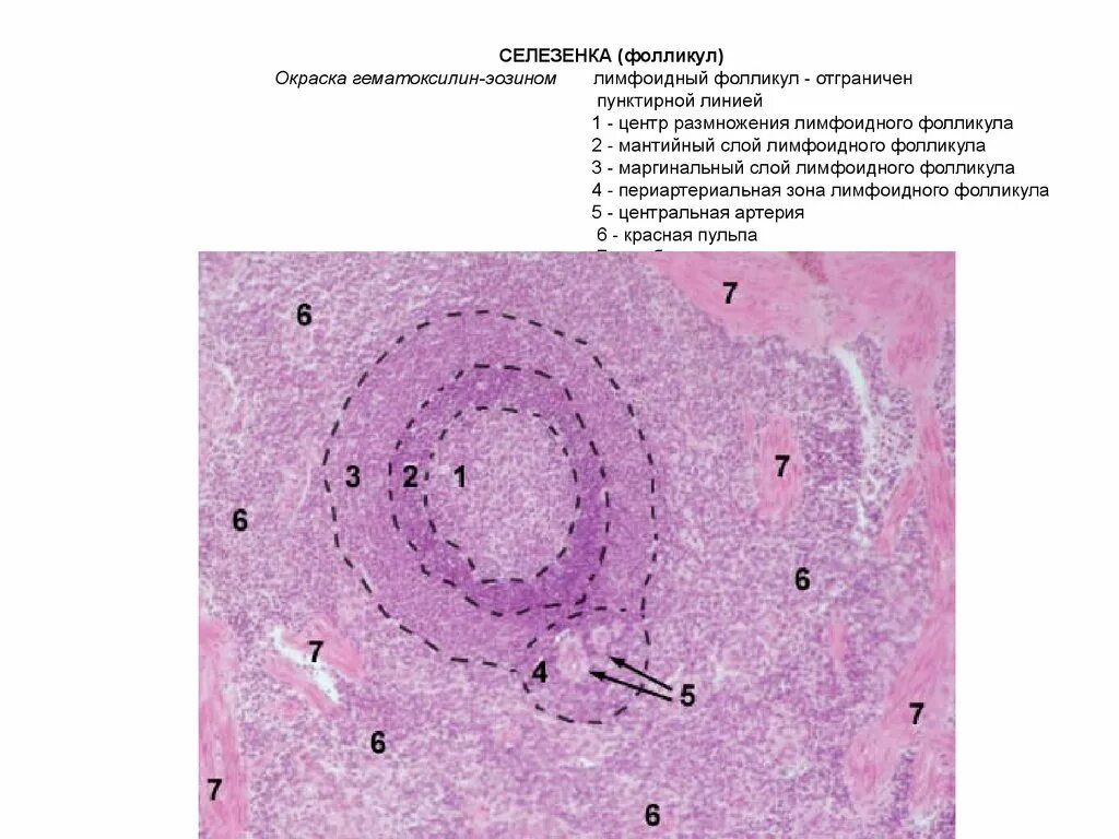Лимфоидный узел гистология препарат. Лимфатический узел гистология препарат. Селезенка гистология препарат. Селезенка гистология препарат гематоксилин. В селезенке образуются клетки