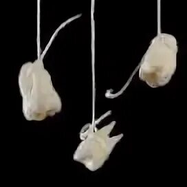 Беременной снится выпал зуб. Беременной снится выпал зуб. Кпк мегяются зубы у детей фото. К чему снится сон что выпал зуб. Во сне выпал гнилой зуб к чему снится.