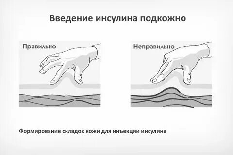 Правильное подкожное введение