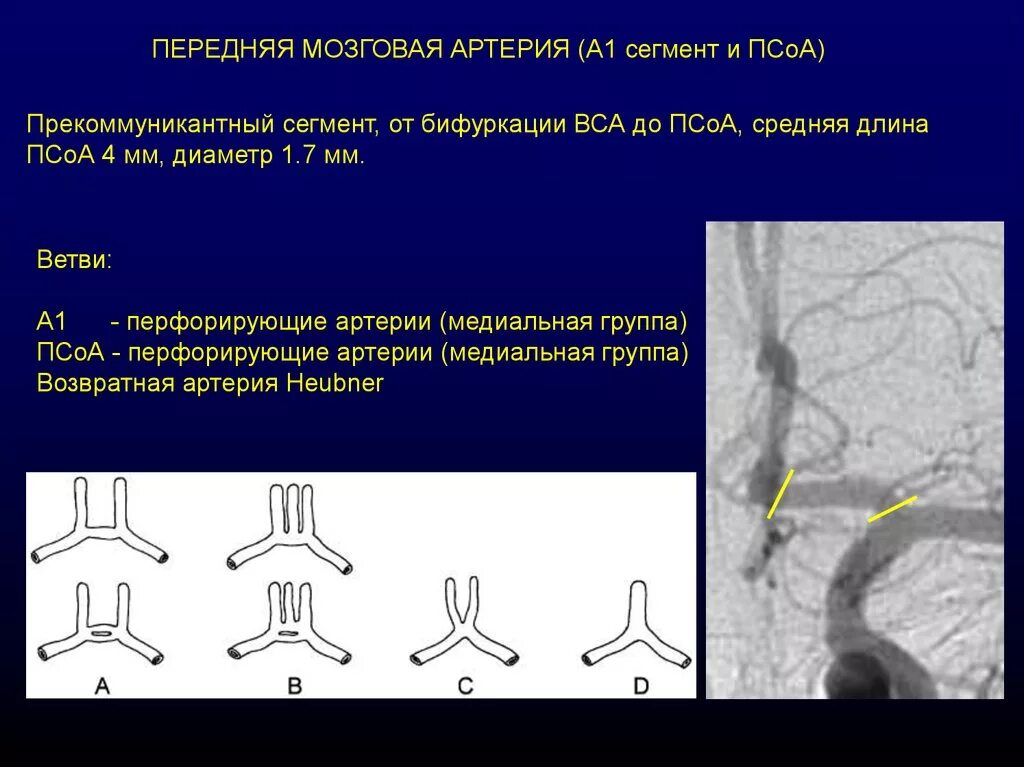 Сегмент а1 пма