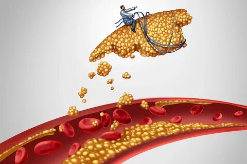 Cholesterol