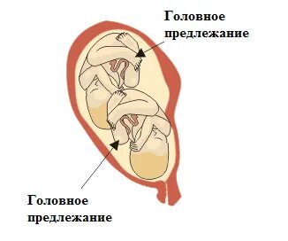 Головное предлежание недели