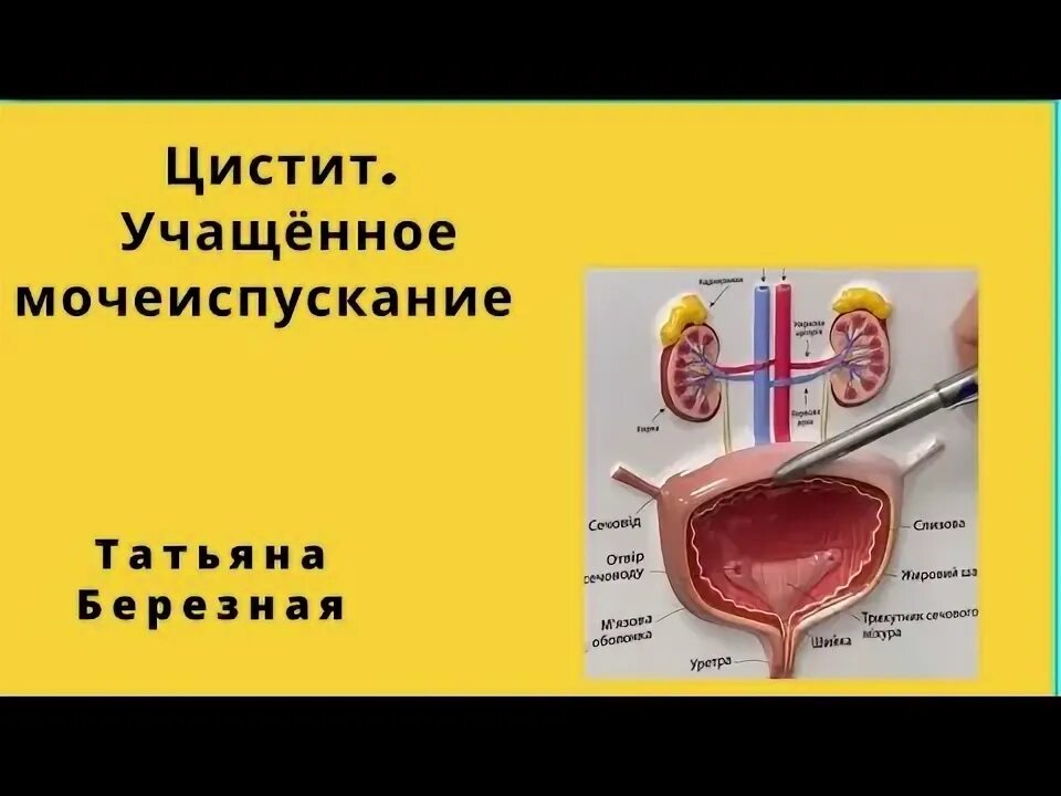 Витамин b мочеиспускание частое. Учащенное мочеиспускание рисунок. 17 ДЦ мочеиспускание частое. Перерыв на мочеиспускание. Высокое давление мочеиспускание