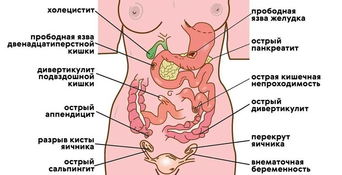От чего могут быть расположены