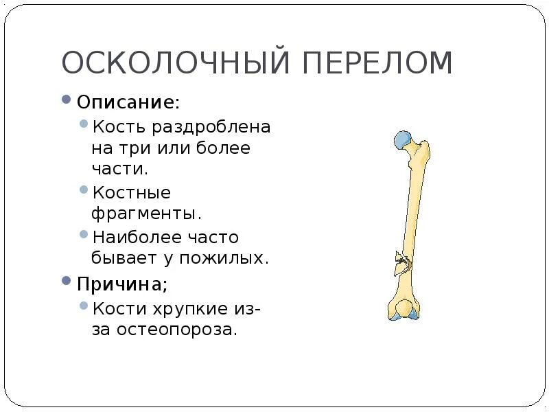 Почему кости легкие. Почему кости становятся хрупкими. Раздробленный перелом латынь. Раздробленный перелом описание.