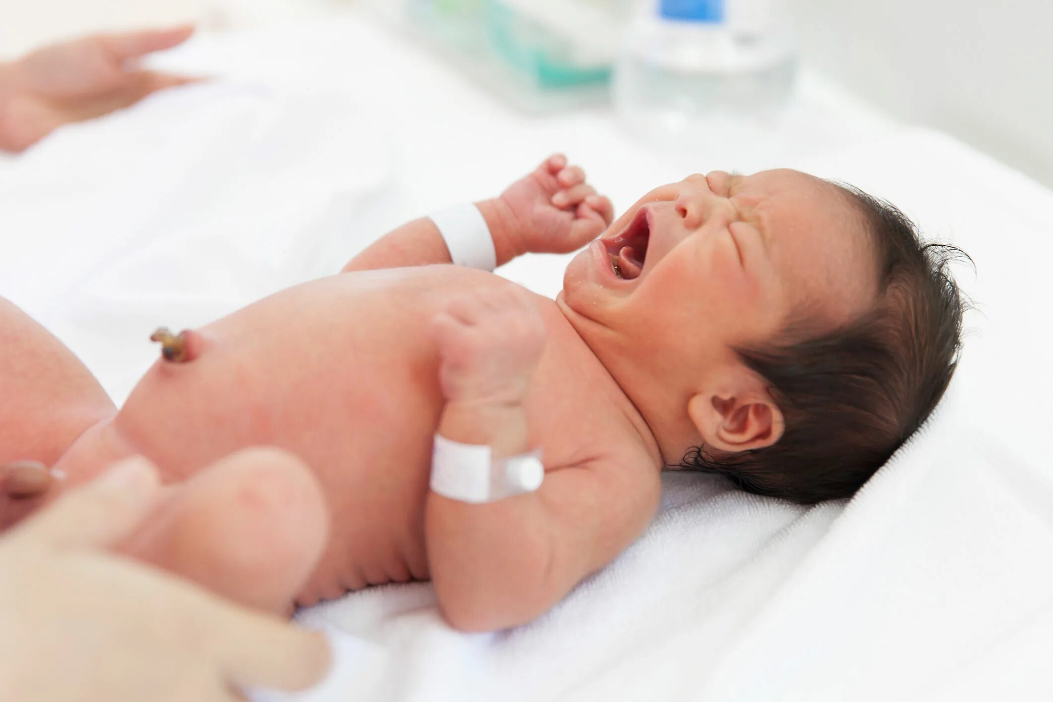 5 день после рождения. Омфалит новорожденных омфалит. Новорожденный ребенок. Новорожденный ребенок пупок. Пупочная ранка у новорожденного.