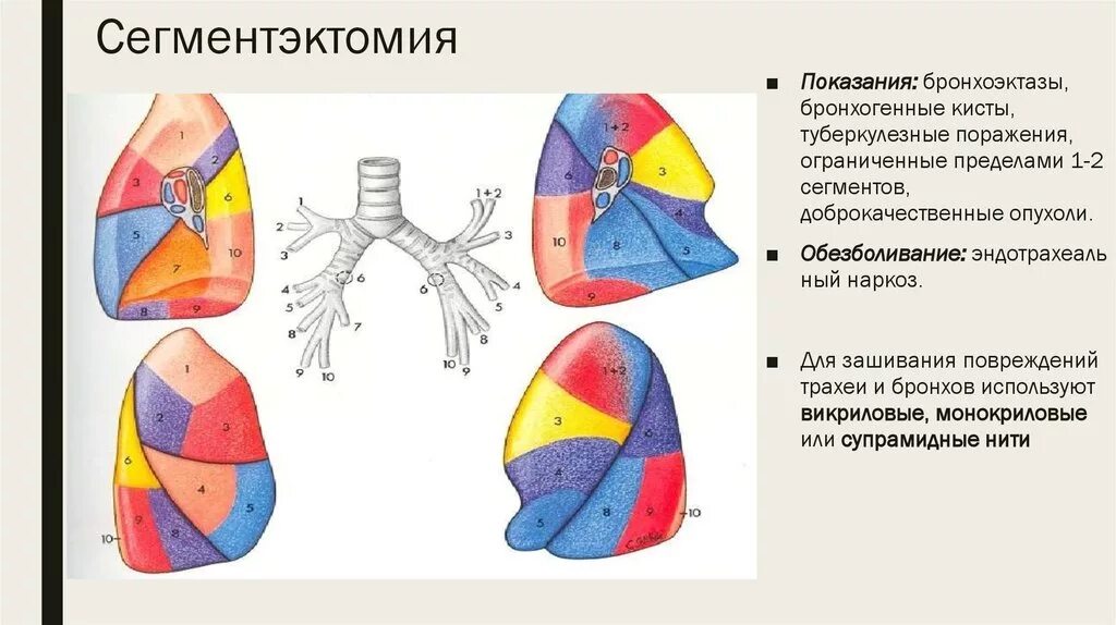 Резекция сегмента легкого. Сегменты легких анатомия. Сегменты легких схема. Операция левого легкого