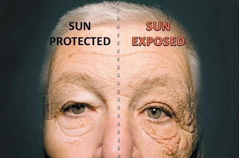 Женщина с морщинами. Старение кожи. Солнце стареет. Фотостарение кожи. Фотостарение.