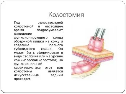 Операция вывод