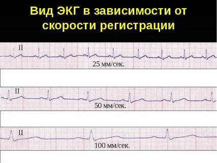 Экг остров