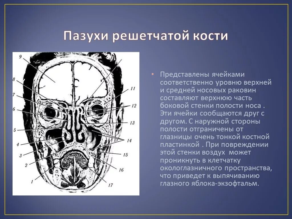 Решетчатый Лабиринт решетчатой кости анатомия. Ячейки решетчатой кости. Стенки решетчатой пазухи. Пазухи решетчатой кости. Утолщение слизистой оболочки решетчатых лабиринтов