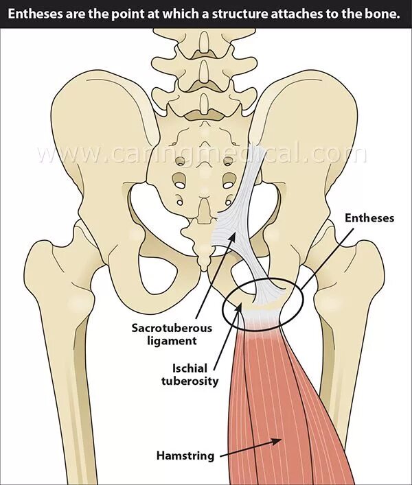 Хамстринг синдром тазобедренного сустава. Хамстринг. ischial tuberosity. sacrotuberous ligament мышца.