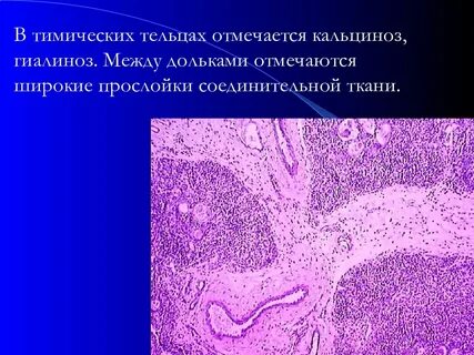 Прослойки соединительной ткани