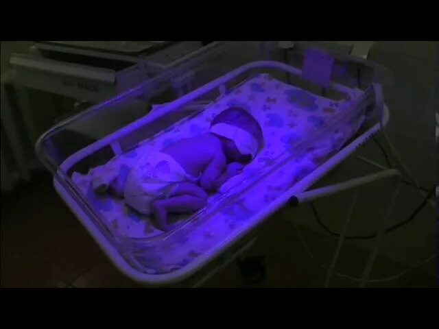 Фототерапия для новорожденных при желтухе. Лампа для фототерапии новорожденных. Лампа для новорожденных от желтушки в роддоме. Ребенок под лампой от желтушки в роддоме.