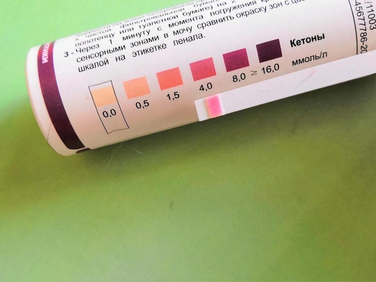 Тест для определения ацетона кетонов в моче. Кетоглюк-1 расшифровка полоски. Ацетон в моче ммоль. Ацетон 1 у ребенка. Лекарства при ацетоне у детей.