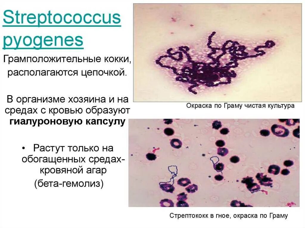 Streptococcus в мазке у мужчин. Патогенные кокки. Грамположительные кокки. Грамположительные кокки микробиология. Гноеродный стрептококк. Окраска стрептококков по Граму.