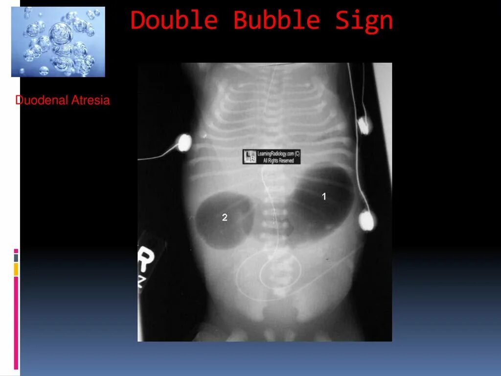 Дабл бабл. Double Bubble канал. Аня Дабл бабл. Ксюша Дабл бабл. Дабл бабл много серий