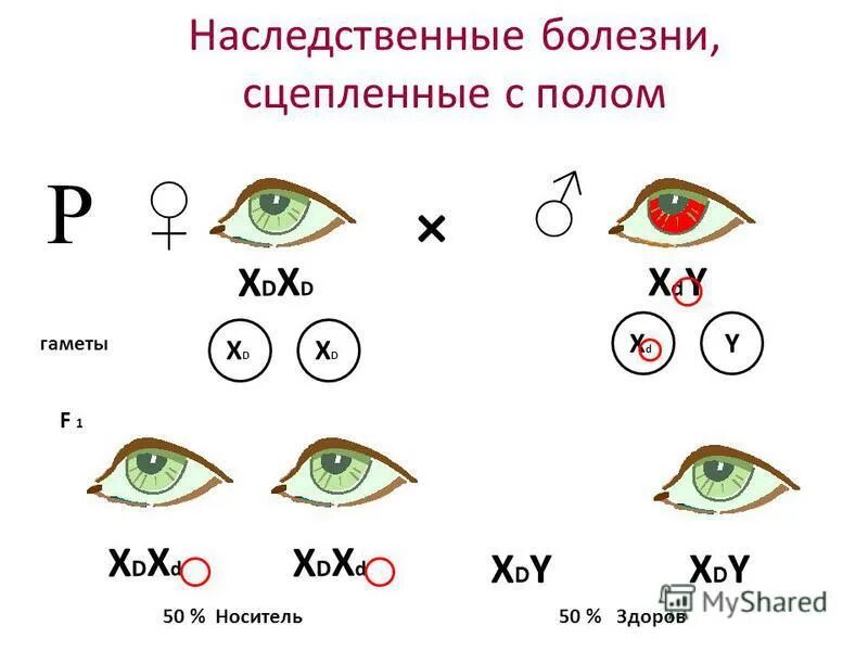 Признак дальтонизма сцеплен с полом. Болезни сцепленные с полом. наследование заболеваний сцепленных с полом.