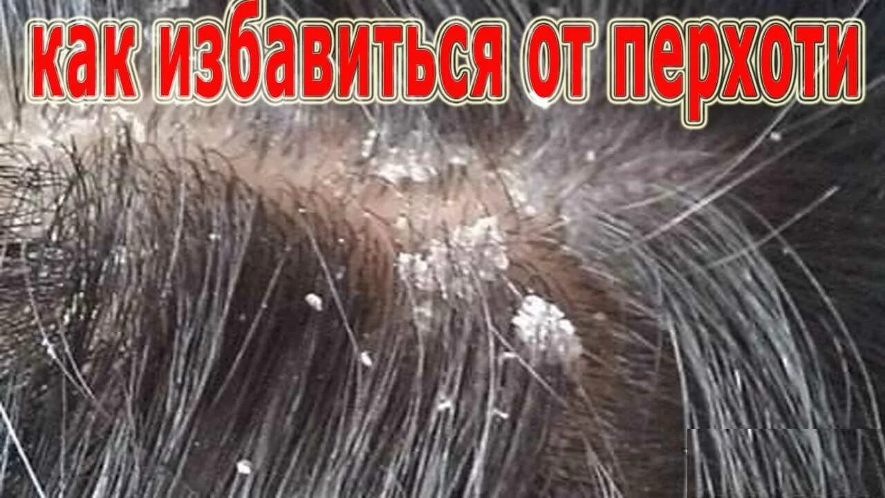 После мытья чешется