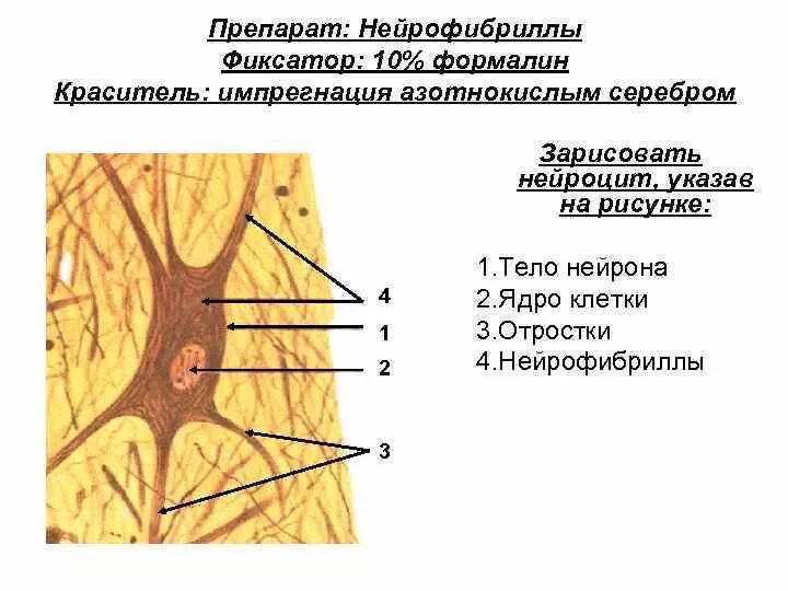 Строение нейрофибриллы гистология. Нейрофибриллы в клетках спинного мозга собаки. Нервные клетки спинного мозга импрегнация серебром. Мультиполярный Нейрон спинного мозга гистология рисунок.