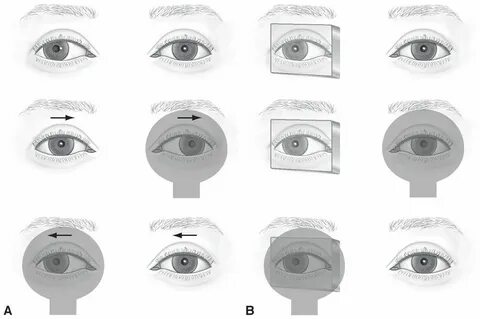 Optical can force the eyes to see