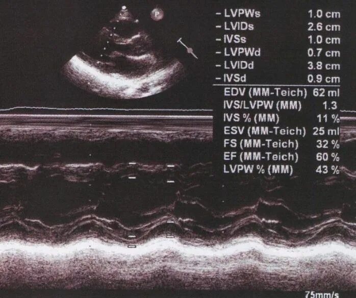 M echo