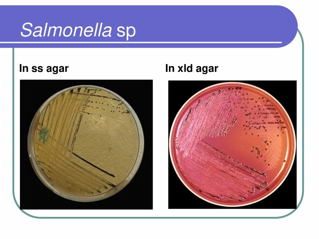 Агар XLD Shigella. XLD агар рост сальмонелл. Среда накопления для сальмонелл. Сальмонелла на XLD. Исследование на сальмонеллез