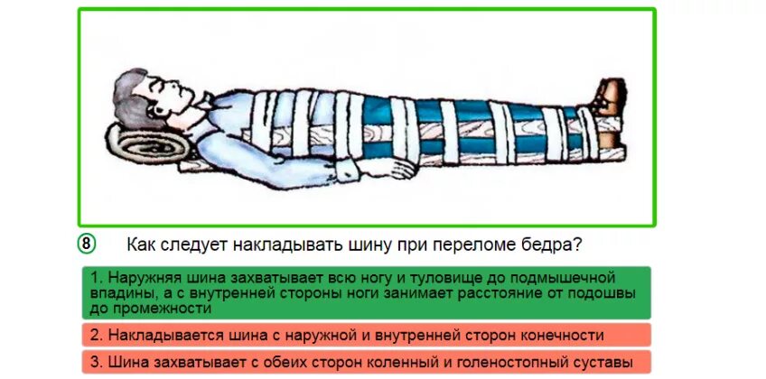 Помощь при открытом переломе бедра. Шина для транспортной иммобилизации при переломе бедра. Наложение шины при переломе бедренной кости. Иммобилизация при переломе бедренной кости. Транспортная шина при переломе бедренной кости.