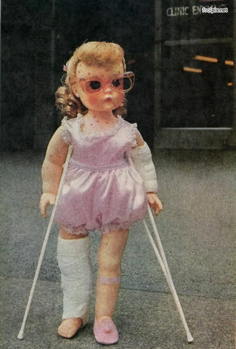 кукла барби инвалид. кукла сломала ногу. кукла сломала ногу. поломанная кукла монстер хай. кукла сломала ногу.