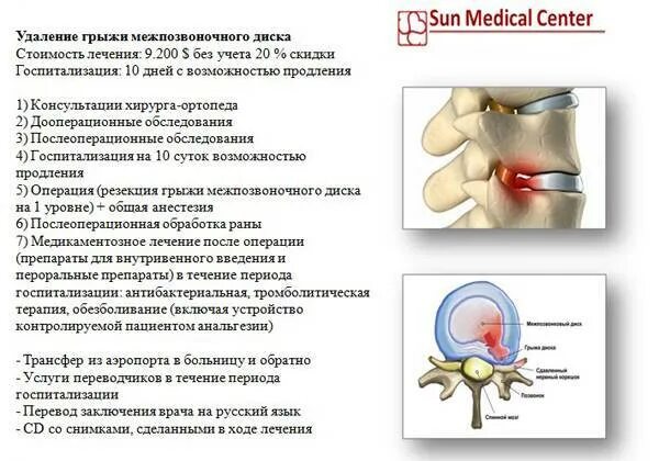 Какую грыжу позвоночника оперируют. Грыжа позвоночника поясничного отдела схема. межпозвоночная грыжа поясничного отдела схема. анализы при грыже позвоночника. операция при грыже поясничного отдела схема.