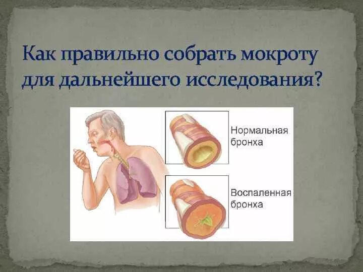 Инфекция с мокротой. Как правильно собрать мокроту для исследования. Исследование мокроты. Сдать мокроту на анализ. Лабораторное исследование мокроты.