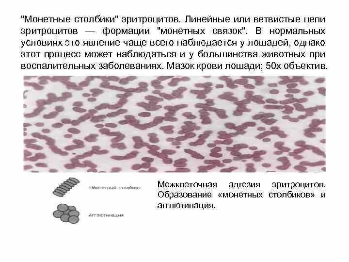 Агрегация эритроцитов это. Агглютинация эритроцитов в виде монетных столбиков. монетные столбики. склеенные эритроциты монетные столбики. монетные столбики эритроцитов причины.