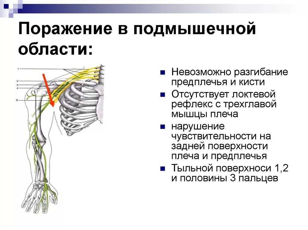 Невропатия подмышечного нерва. Подмышечный нерв иннервация. Срединный нерв нерв анатомия. Невропатия подкрыльцового нерва.