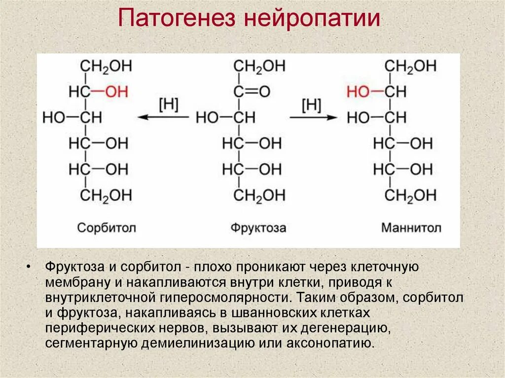 Сорбитол во фруктозу. Патогенез нейропатии. Сорбитол и маннитол. Метаболизм сорбита.