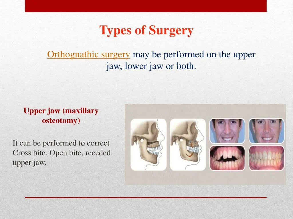 Surgery перевод