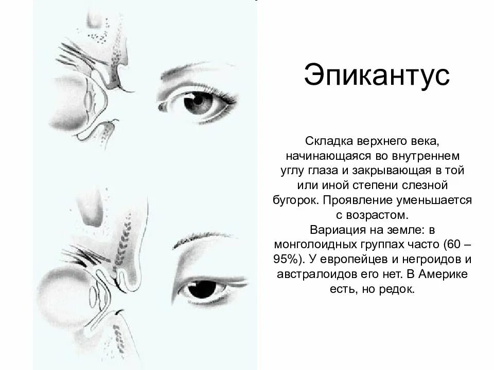 Монголоидная складка эпикантус. Монгол эпикантус. Монгол эпикантус. Эпикантус признак. Эпикантус у чувашей.