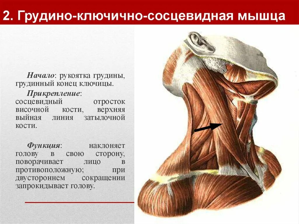 Боли сосцевидной мышцы