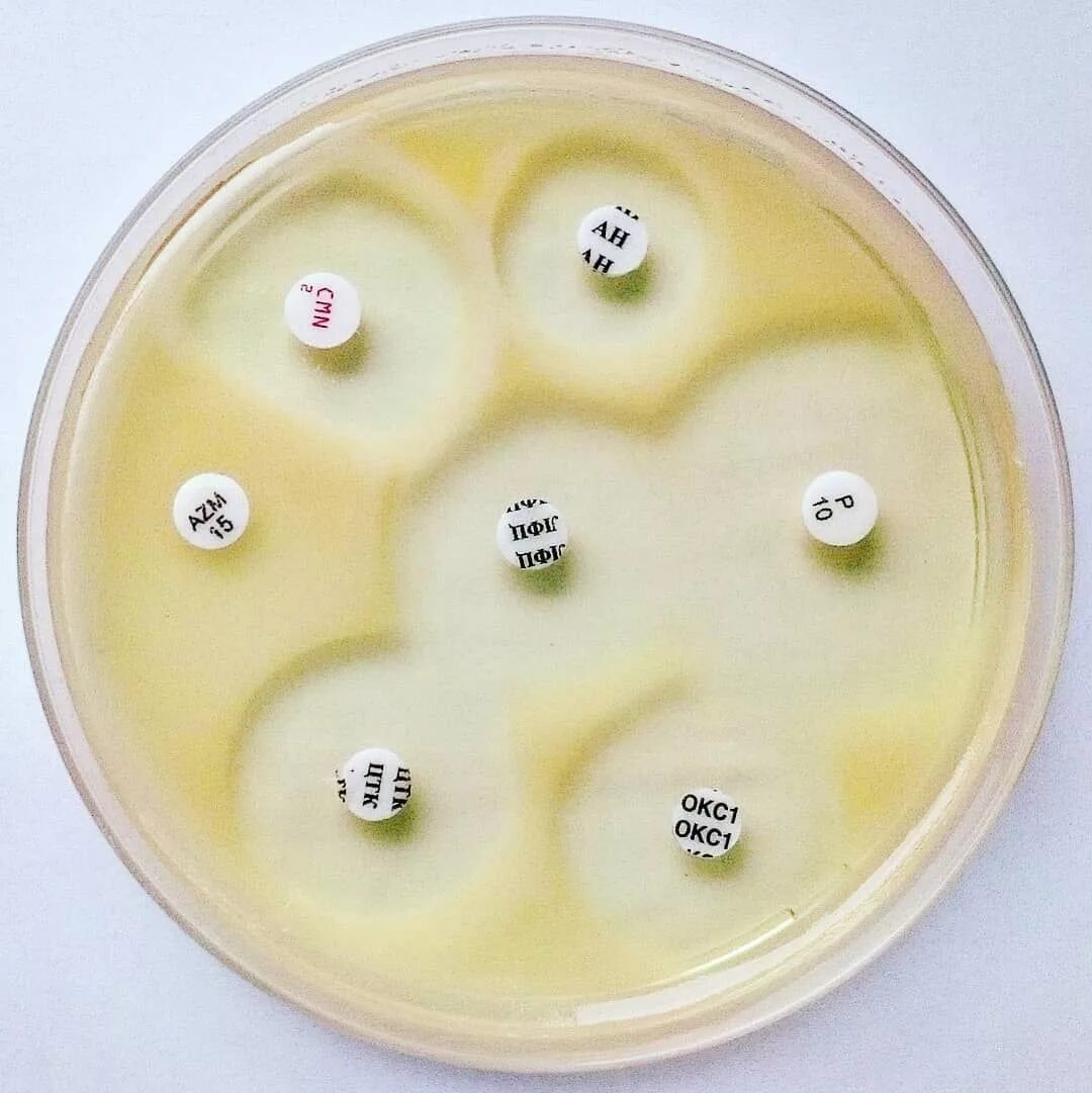 Стафилококк в чашке Петри. Чашка Петри с агаром. Чашка Петри микробиология. Золотистый стафилококк на чашке Петри. Staphylococcus aureus антибиотики