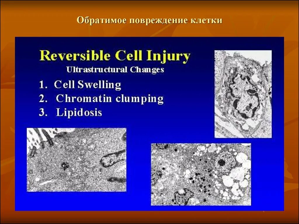 Тест повреждение клетки. Обратимое повреждение клеток. Поврежденная клетка. Морфология повреждения клеток. Обратимые изменения клетки.