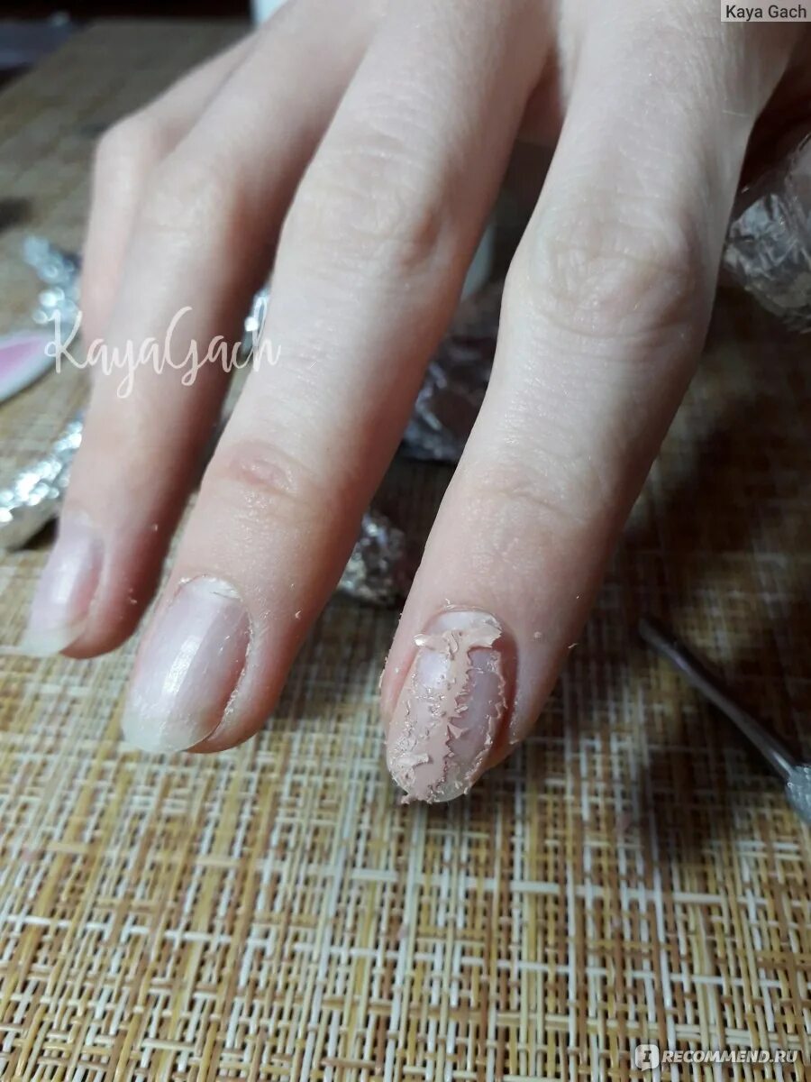Сняла гель лак сама. Сняла гель лак сама. Ногти после самостоятельного снятия гель лака. Сняла гель лак сама. Снятие гель лака без маникюра.