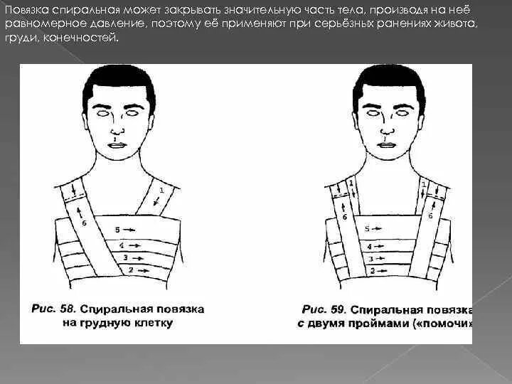 Спиральная повязка алгоритм. Спиральная повязка. Спиральная повязка на грудную клетку. Повязка спиральная на жвиот.