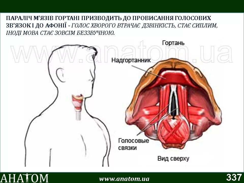 Ларингит сколько дней длится. Голосовые связки ларингит.